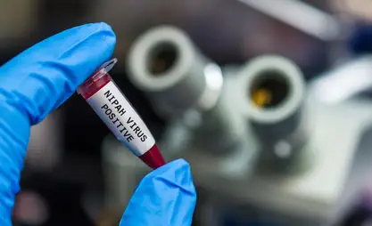 Нипах вирусу: Индиядан мал жана эт азыктарын алып келүүгө тыюу салынды