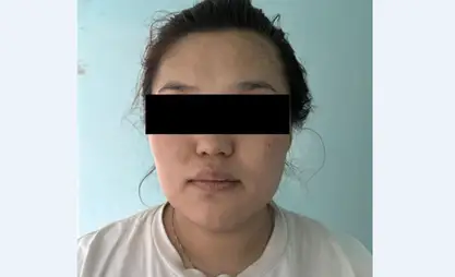 Сокулукта таштандыдан жаңы төрөлгөн ымыркайдын сөөгү табылды