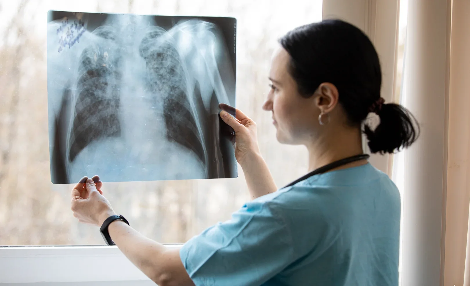 DS2023_TUBERCULOSIS.2e16d0ba.format-webp.fill-1668x1014.webp