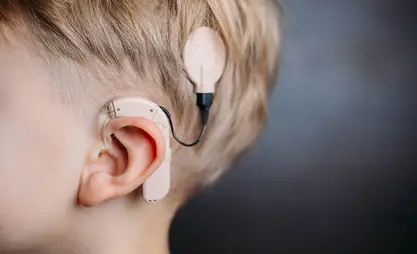 Өлкөдө кохлеардык импланты бар 500гө жакын бала каттоодо турат